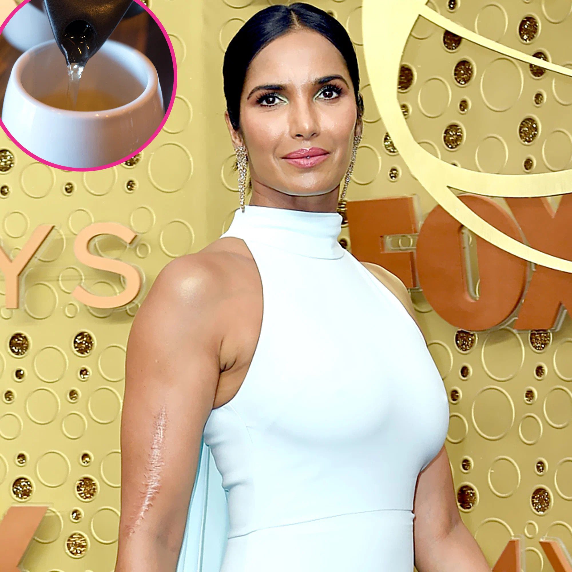 Padma Lakshmi scar